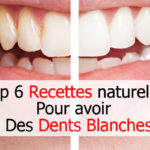 6 Recettes naturelles pour avoir des dents blanches - Des dents blanches rapidement