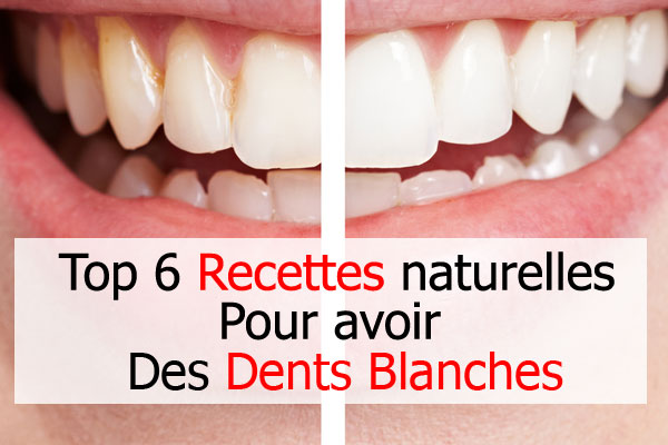 6 Recettes naturelles pour avoir des dents blanches - Des dents blanches rapidement