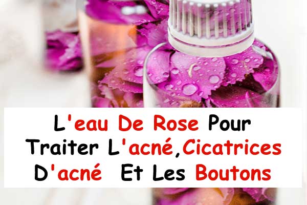Les Bienfaits De L'eau De Rose Pour Traiter L'acné, Cicatrices D'acné Et Les Boutons