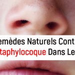 Remèdes Naturels Contre le Staphylocoque dans le nez